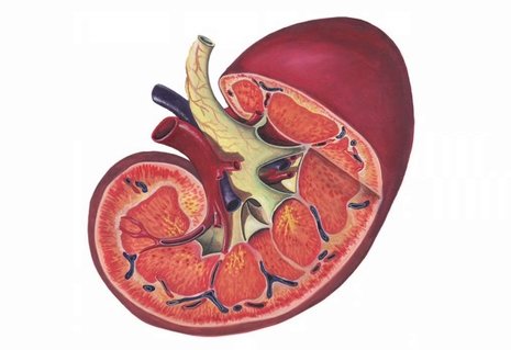 Get Rid Of Kidney Failure 